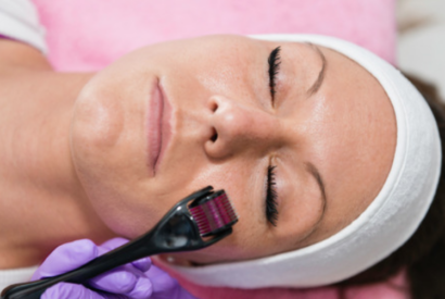 Medizinisches Micro-Needling